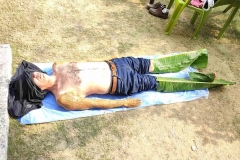 Cure@72hrs-HIIMS-Gurgam-24